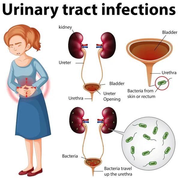 Urinary tract health